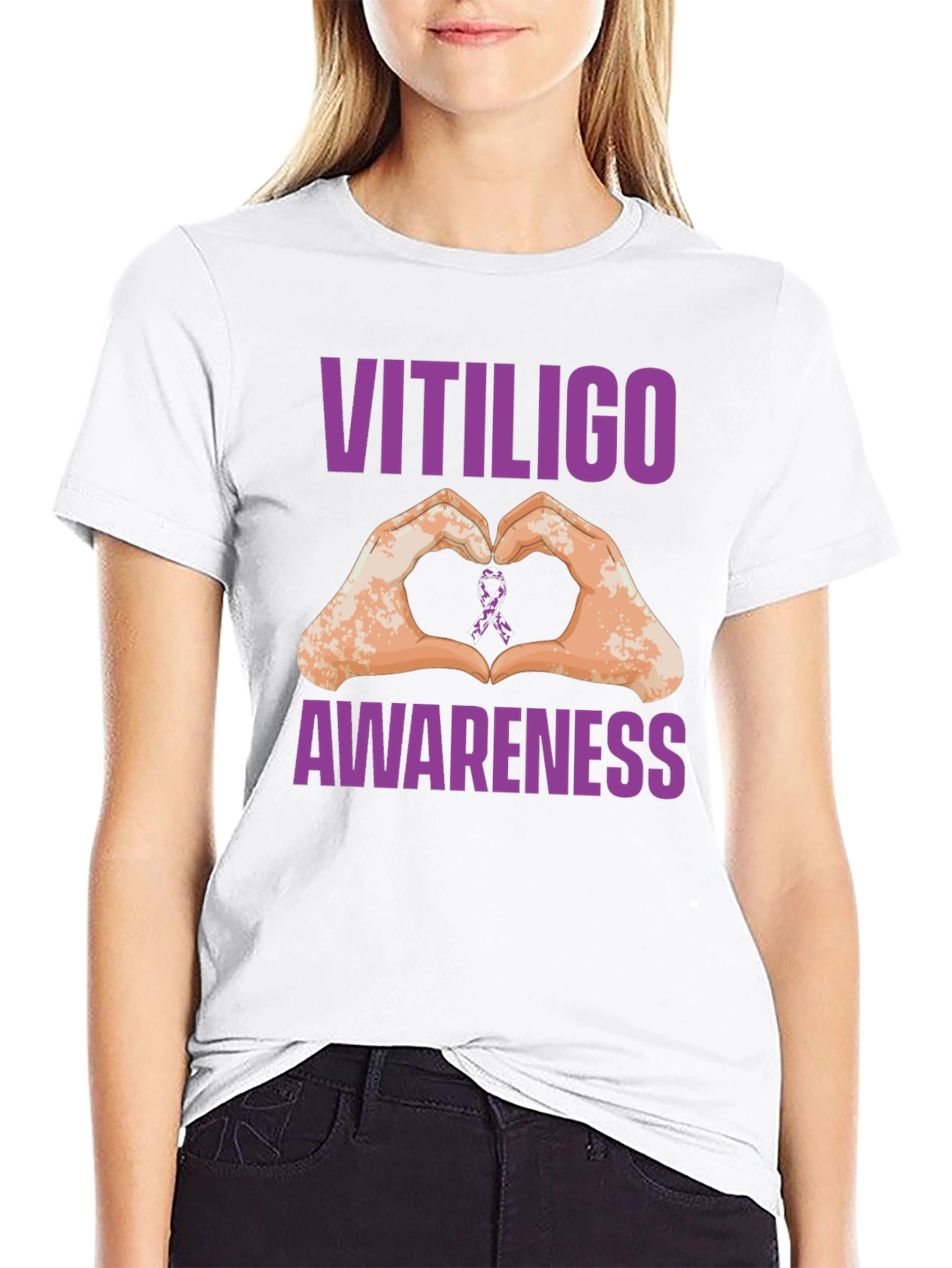Vitiligo Awareness Heart Hands T-Shirt