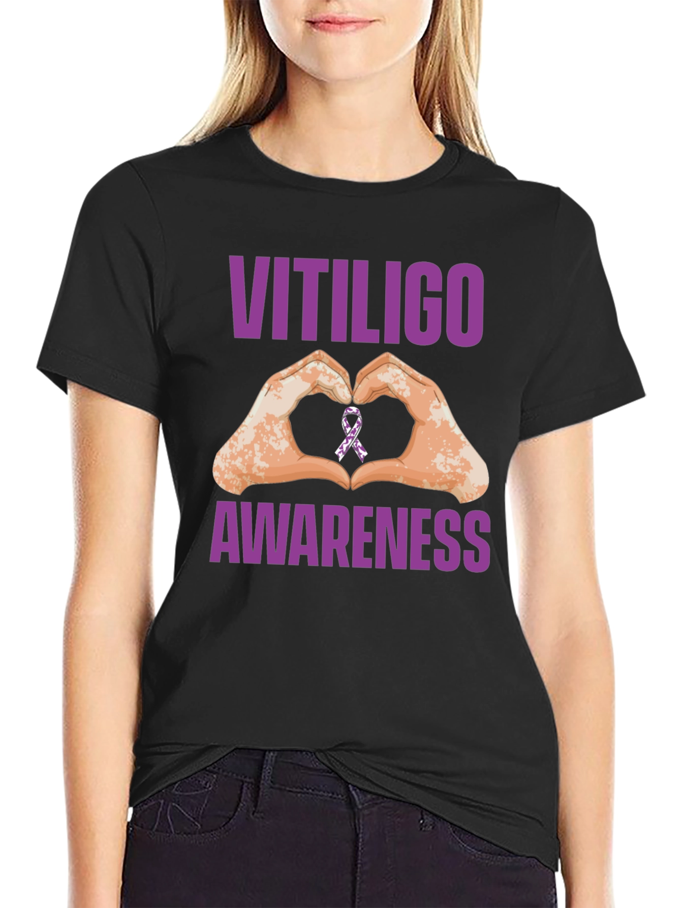 Vitiligo Awareness Heart Hands T-Shirt