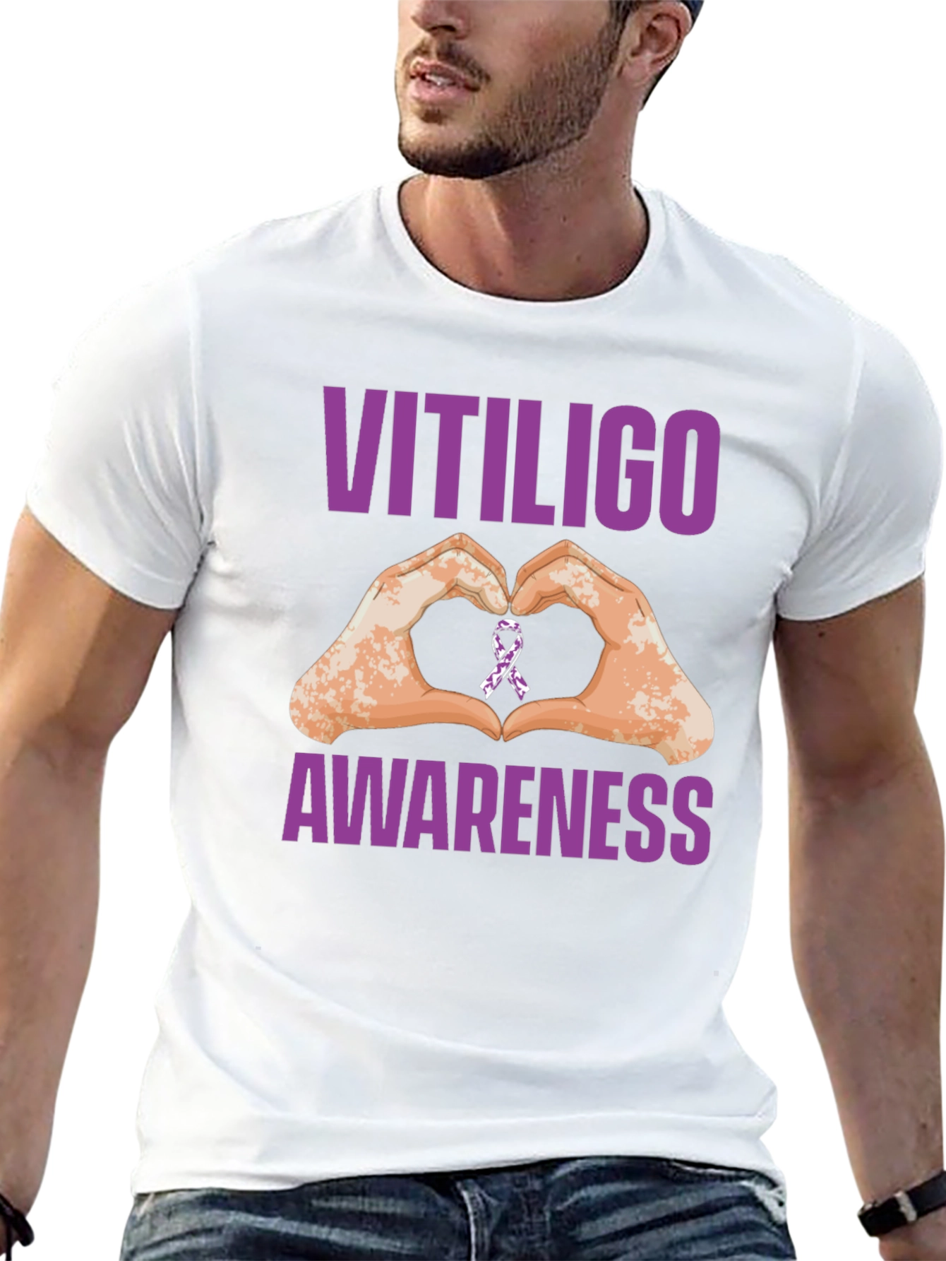 Vitiligo Awareness Heart Hands T-Shirt